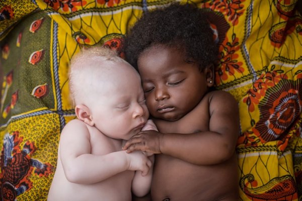 Альбинос и африканец спят обнявшись - Эмоции людей