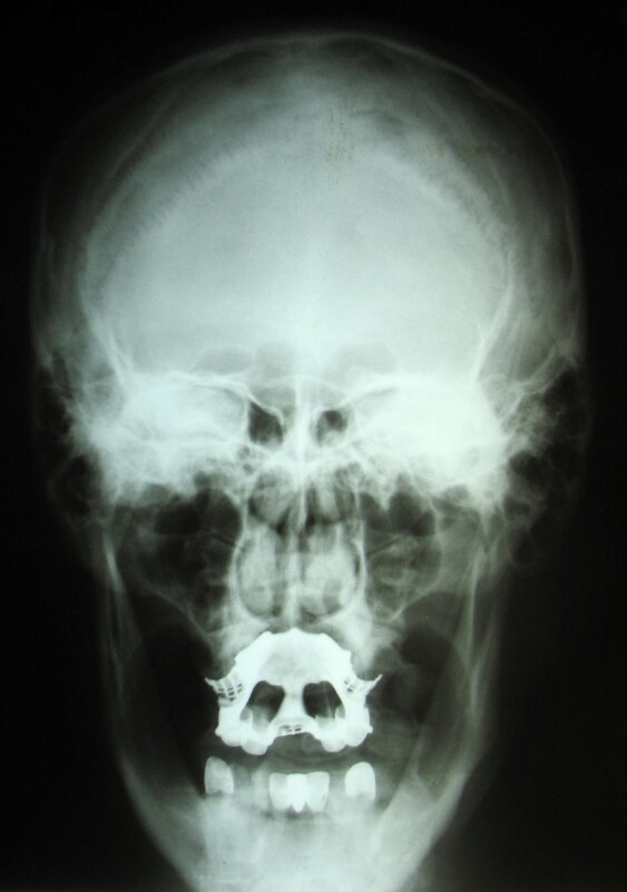 Краниография - Андрей Л. В. Краниография - Андрей Л. В.