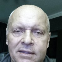 На второй день после имплантации :: Валерий Иванович На второй день после имплантации :: Валерий Иванович