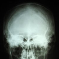 Краниография :: Андрей Л. В.